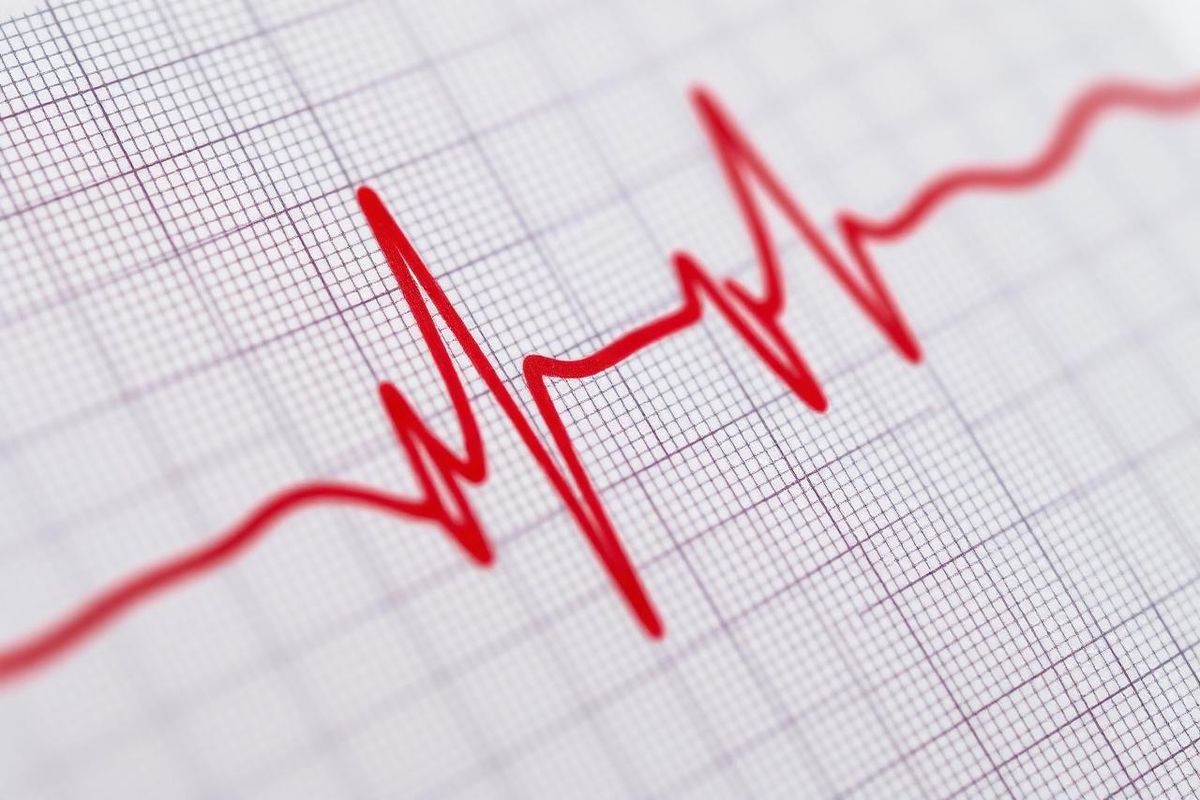 What Your ECG Cannot See